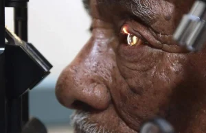 Innovación médica en la UNAM: Inicia escaneo facial para prevenir enfermedades