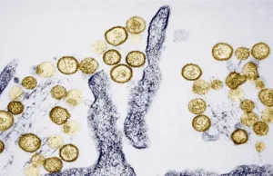 Alerta en Argentina: Suben casos de hantavirus en punto de origen del crucero infectado